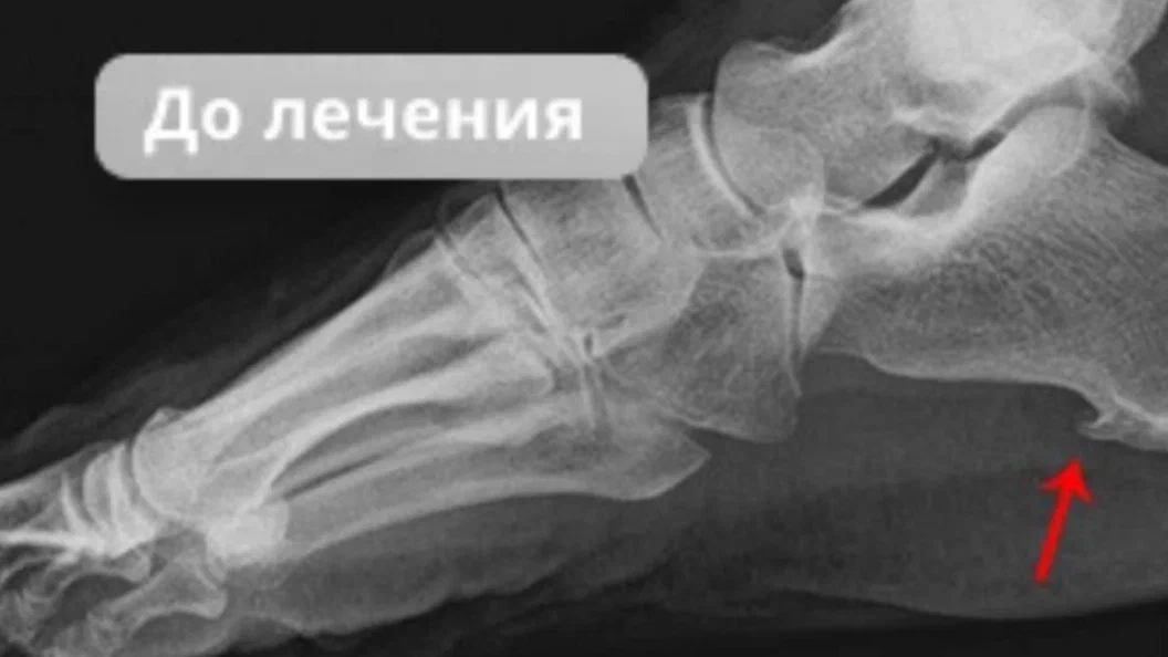 Лечение