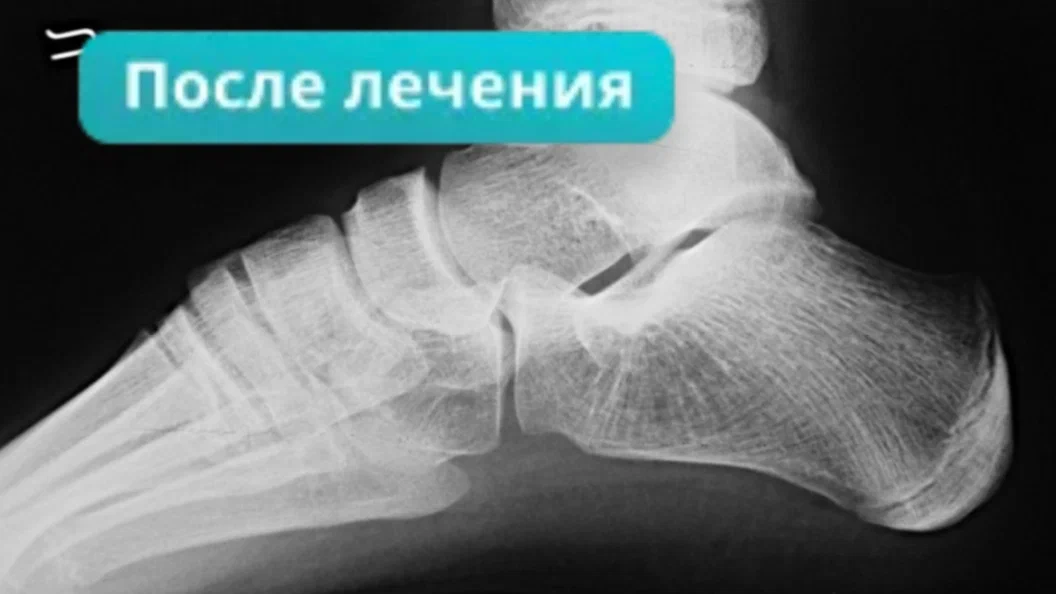 После лечения